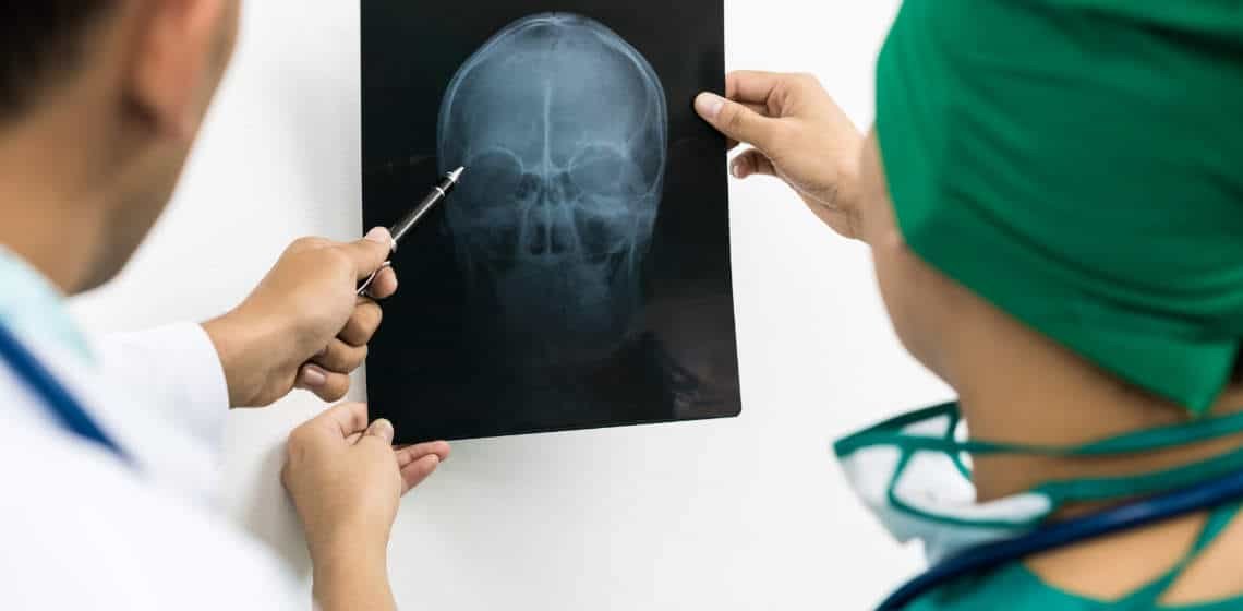 head injury background image