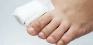 broken toe compensation claims