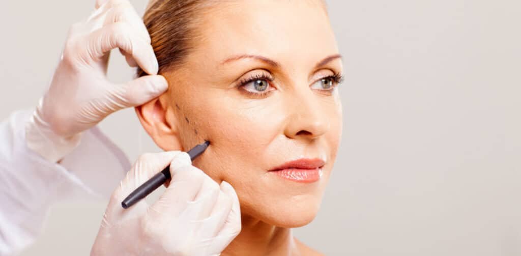 facelift negligence claims