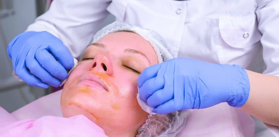 chemical peel claims