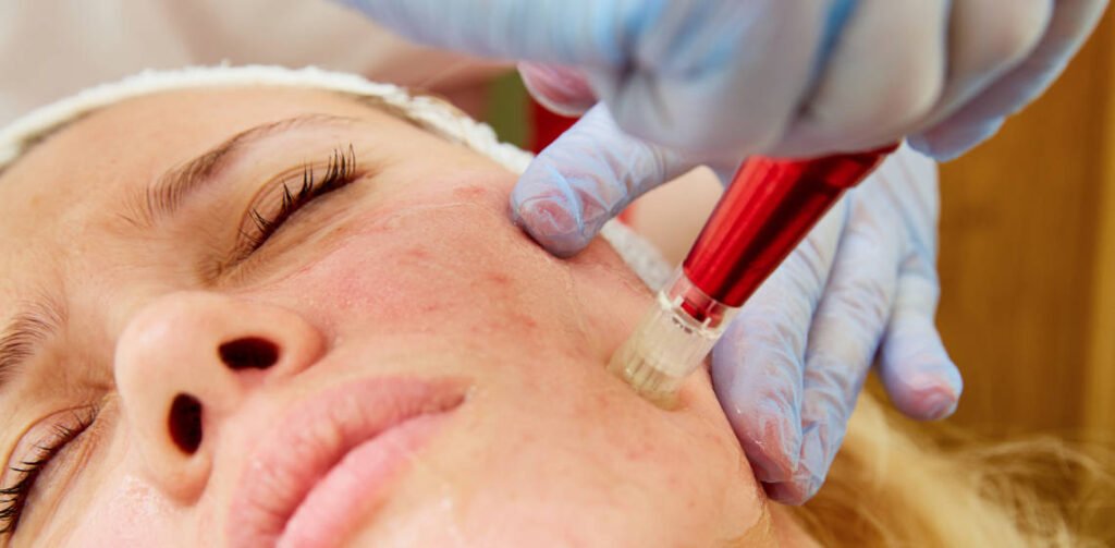 dermabrasion injury claims