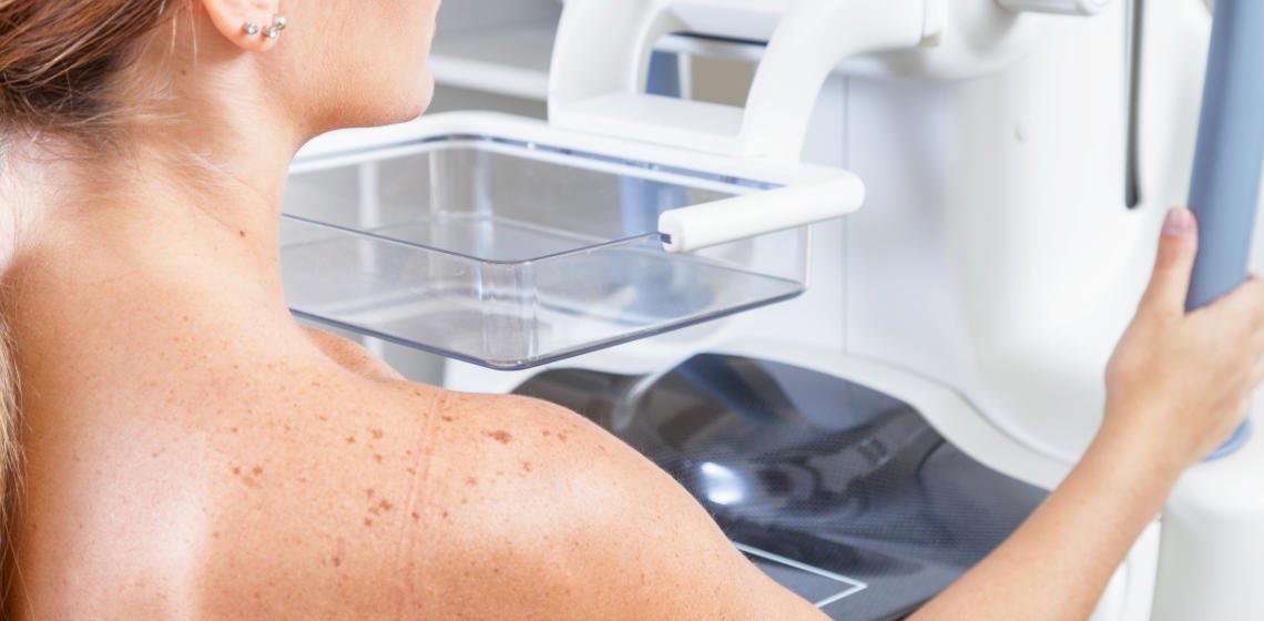 breast cancer misdiagnosis claim