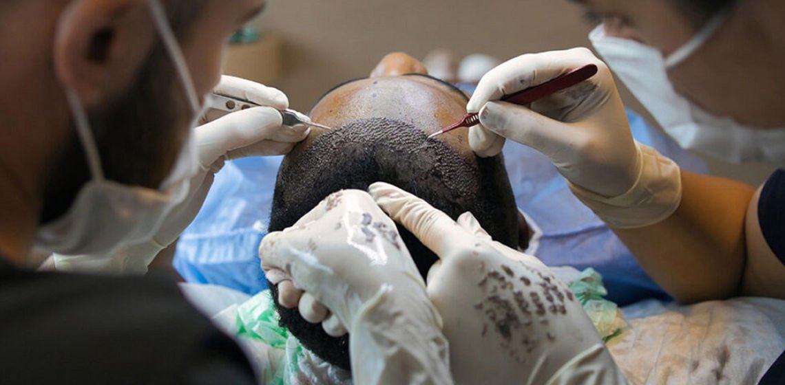 hair transplant claims